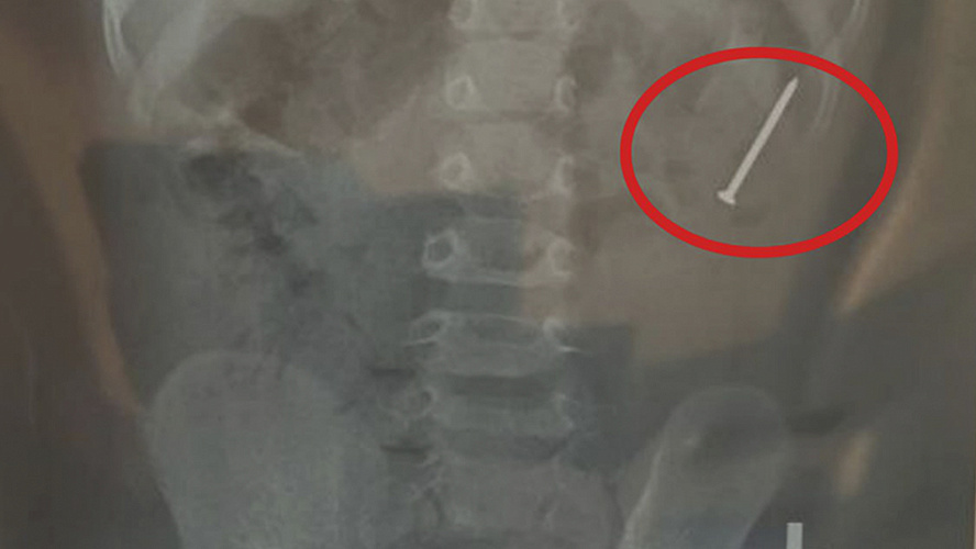 Фото: ЦГБ Ноябрьск