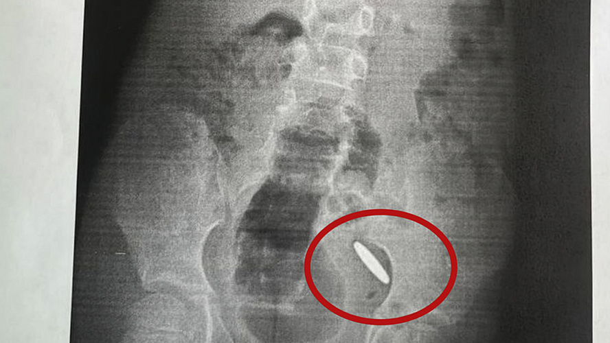 Фото: ЦГБ Ноябрьск